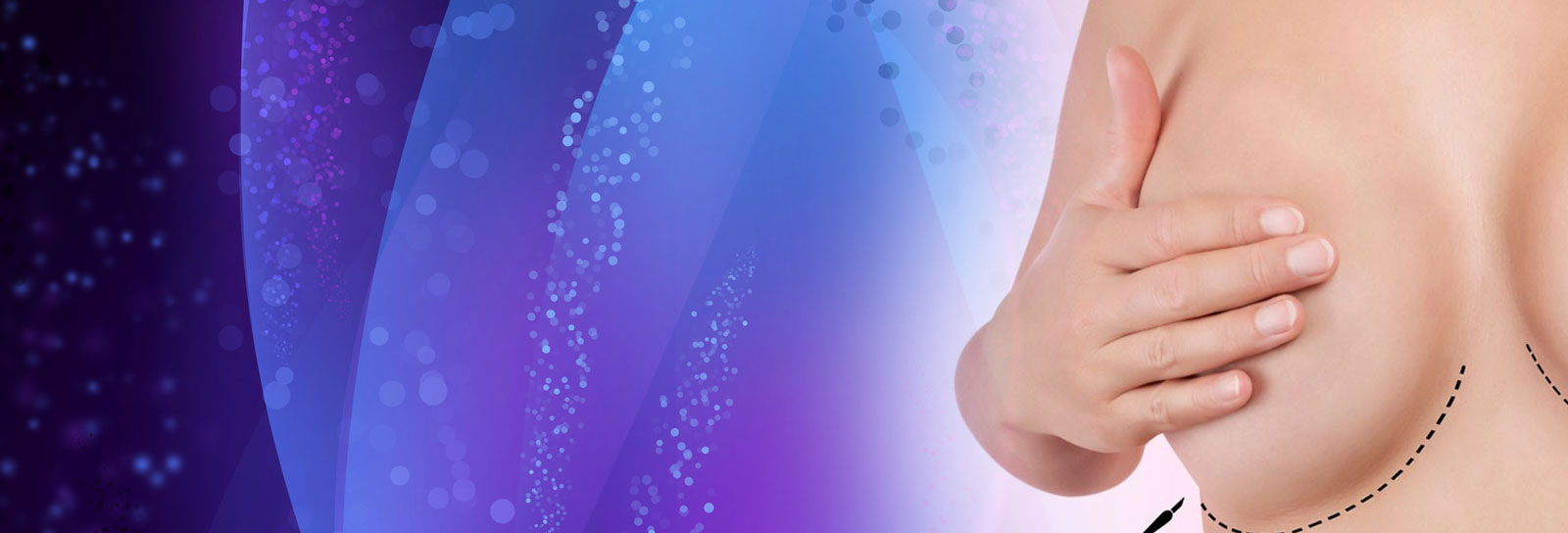 Plastic Surgery of the Breast